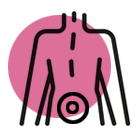 Sciatica